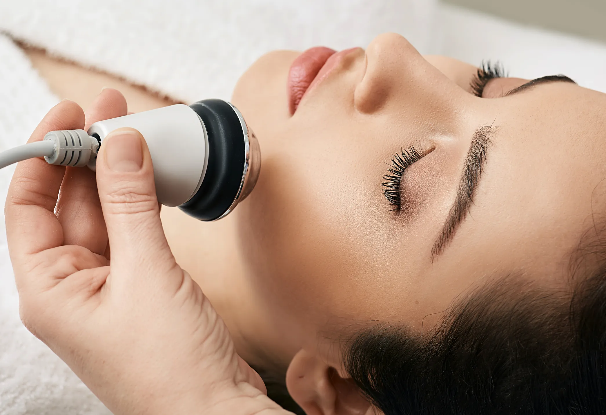 Procedure and Side Effects of Radiofrequency (RF) Microneedling