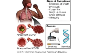 COPD Conditions: Symptoms, Causes & Prevention