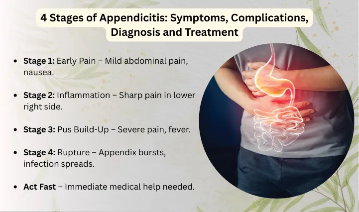 4 Stages of Appendicitis: Symptoms, Complications, Diagnosis and Treatment
