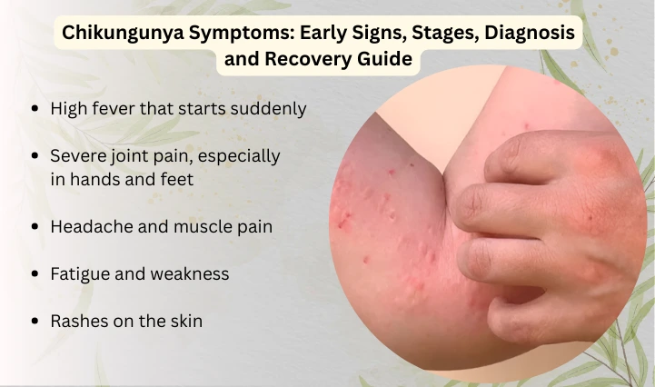 Chikungunya Symptoms: Early Signs, Stages, Diagnosis and Recovery Guide