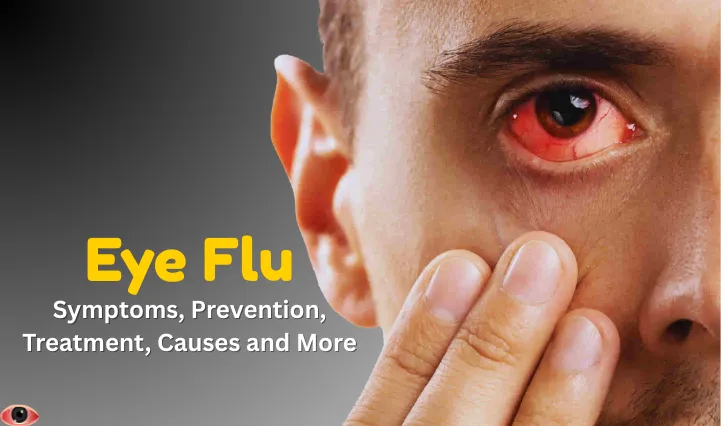 Eye Flu: Symptoms, Prevention, Treatment, Causes and More