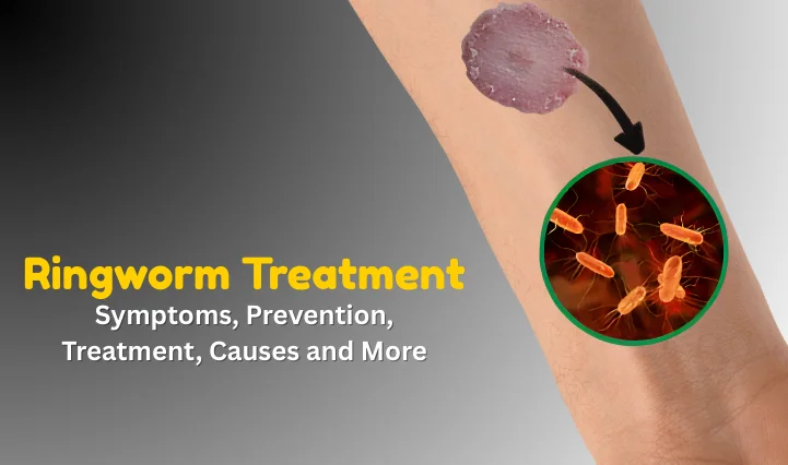 Ringworm Treatment: Causes, Symptoms, Remedies & Care