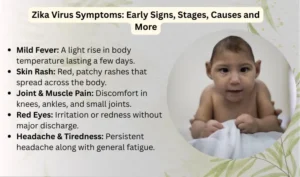 Zika Virus Symptoms