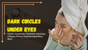 Dark Circles Under Eyes