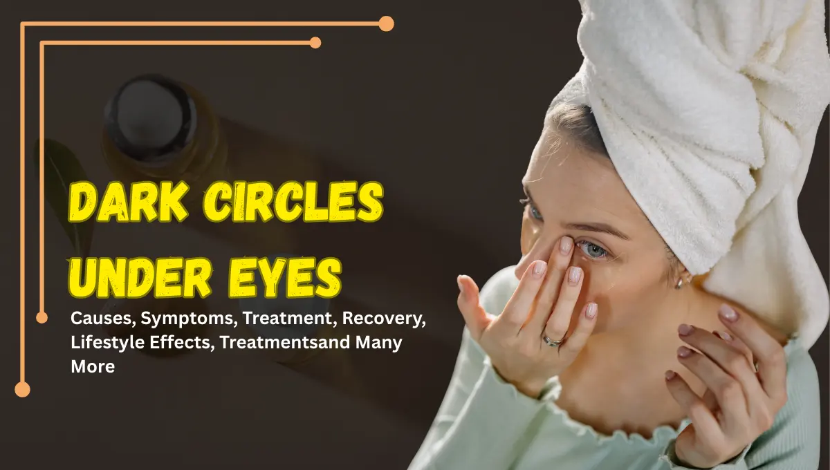 Dark Circles Under Eyes: Causes, Lifestyle Effects, Treatments & When to Seek Help