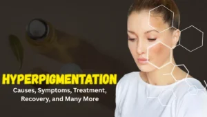 hyperpigmentation