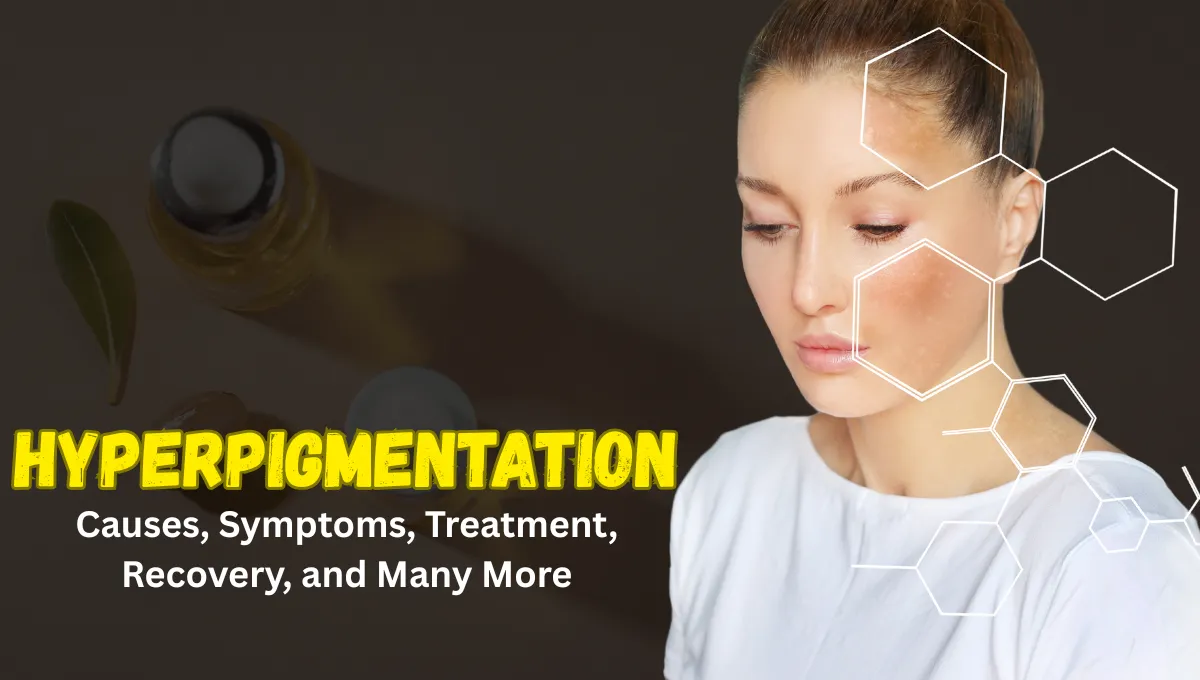 hyperpigmentation