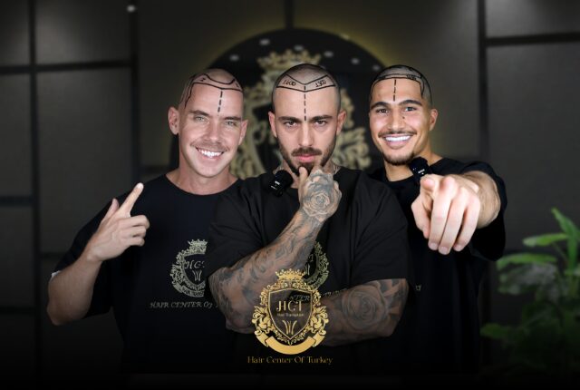 Hair Transplant Clinics in Turkey