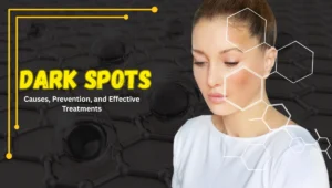 Dark Spots