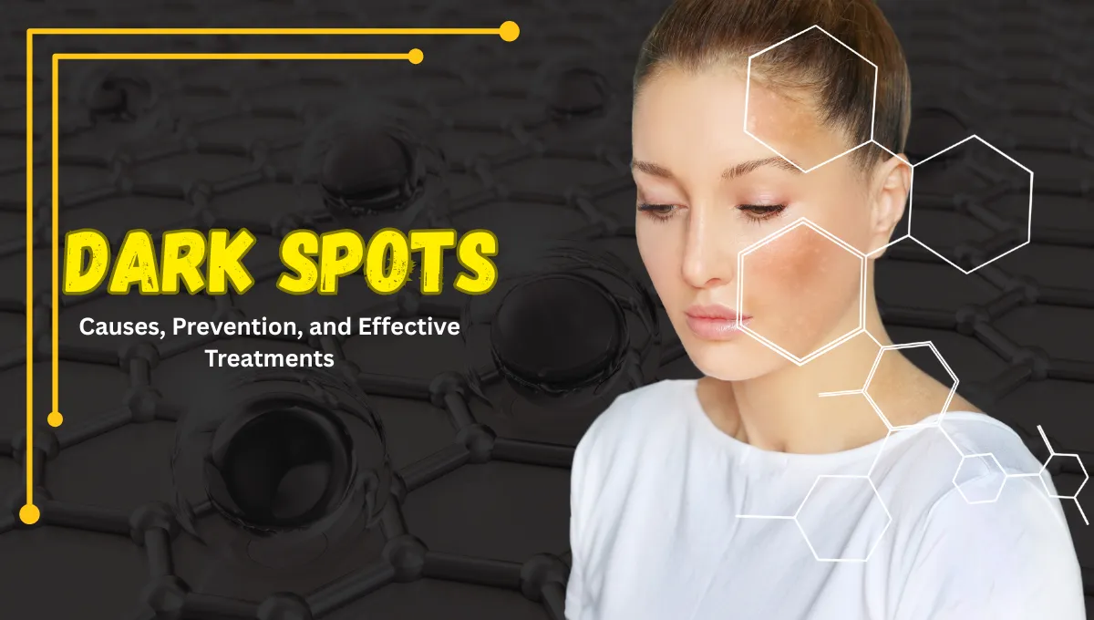 The Ultimate Guide to Dark Spots: Causes, Prevention, and Effective Treatments